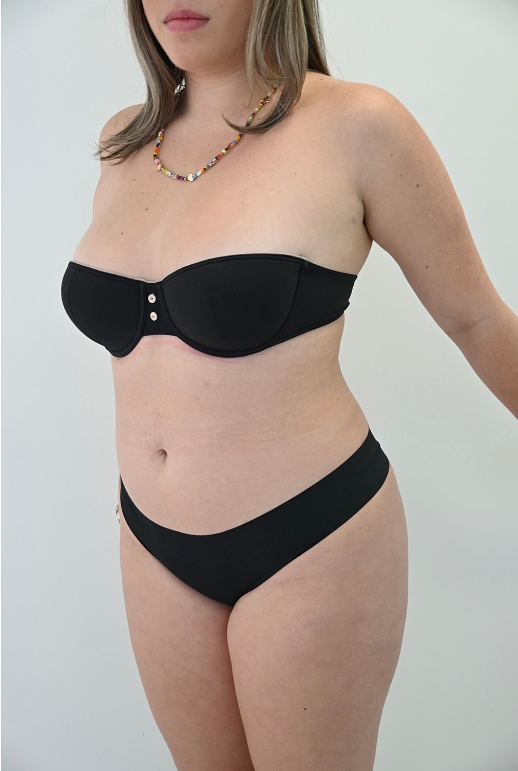 Liposuccion Abdomen Before & After